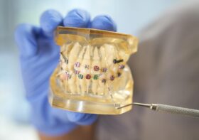 Pierwsza wizyta u ortodonty – co musisz o niej wiedzieć?